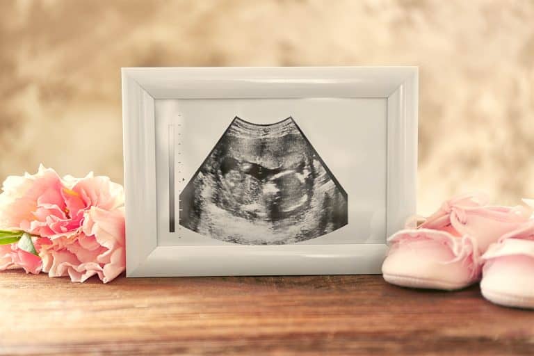 duelo perinatal