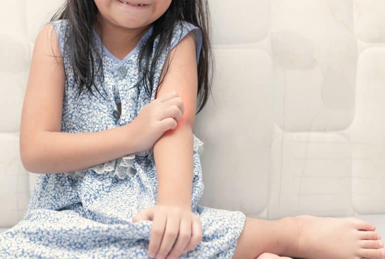 psoriasis en los niños Psoriasis en los niños: Causas, síntomas y tratamiento