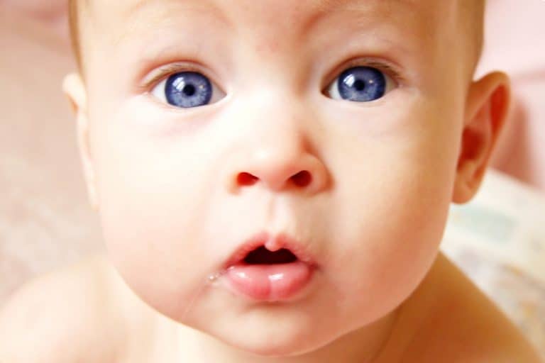 aniridia en los niños Aniridia en los niños: Qué es, qué la provoca