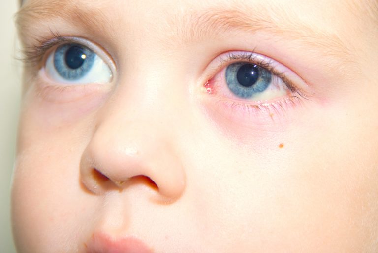 cuidado ojos niños Limpieza y cuidados de los ojos en niños