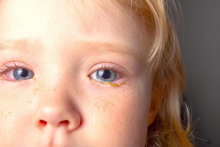 cuidado ojos niños Limpieza y cuidados de los ojos en niños