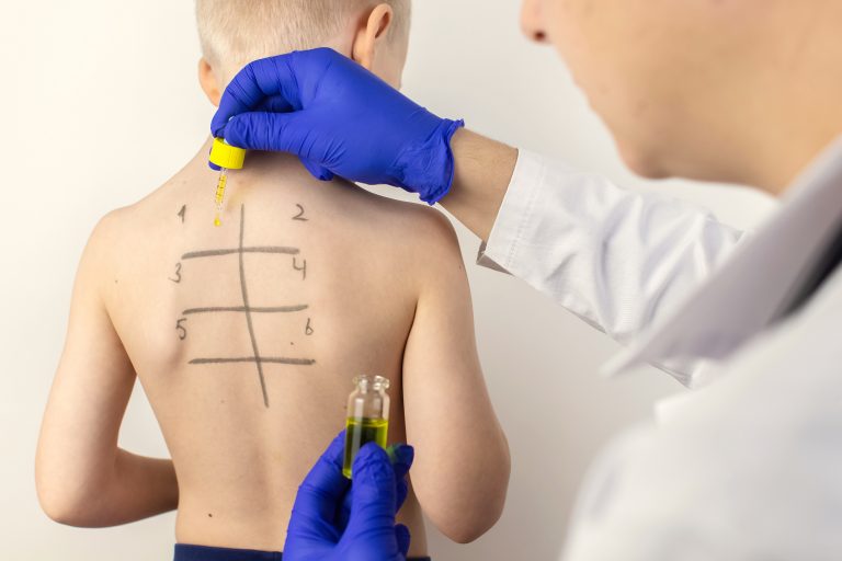 Exposición temprana a los antibióticos y asma y alergias en niños