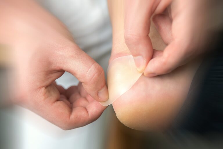 Leche para heridas: Acelera la curación